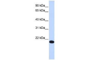 WB Suggested Anti-YAF2 Antibody Titration:  0. (YAF2 抗体  (Middle Region))