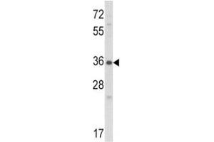 Western blot analysis of Connective Tissue Growth Factor antibody and NCI-H460 lysate. (CTGF 抗体  (AA 315-349))