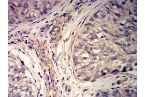 Immunohistochemistry (IHC) image for anti-Myosin Light Chain Kinase (MYLK) (AA 1375-1524) antibody (ABIN7193606)