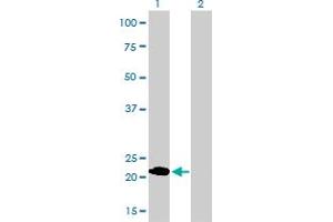 Western Blotting (WB) image for anti-Myosin, Light Chain 1, Alkali, Skeletal, Fast (MYL1) (AA 1-80) antibody (ABIN518149)