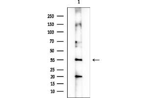 anti-Interleukin 15 Receptor, alpha (IL15RA) (Internal Region) antibody