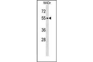 Western blot analysis of NUP50 Antibody (Center) in WiDr cell line lysates (35ug/lane). (NUP50 抗体  (Middle Region))