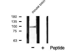 Western blot analysis of HSP90B phosphorylation expression in mouse brain tissue lysates,The lane on the right is treated with the antigen-specific peptide. (HSP90AB1 抗体  (pSer254))