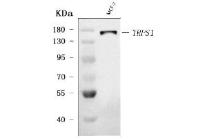 Western blot analysis of TRPS1 using anti-TRPS1 antibody (ABIN7601443). (TRPS1 抗体  (AA 353-1257))
