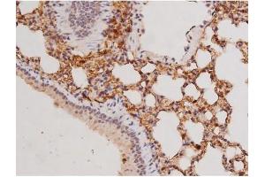 ABIN6269133 at 1/200 staining Mouse lung tissue sections by IHC-P. (KIT 抗体  (Internal Region))