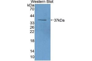 Western blot analysis of the recombinant protein. (beta-Thromboglobulin 抗体  (AA 46-107))