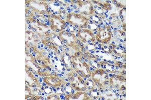 Immunohistochemistry (IHC) image for anti-Chromosome 18 Open Reading Frame 8 (C18orf8) (AA 1-300) antibody (ABIN7266379)