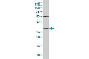 CRYBB1 monoclonal antibody (M03), clone 3D9 Western Blot analysis of CRYBB1 expression in MCF-7 . (CRYBB1 抗体  (AA 37-137))