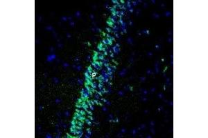 Expression of Gastric inhibitory polypeptide receptor in rat hippocampus - Immunohistochemical staining of perfusion-fixed frozen rat brain sections using Anti-GIPR (extracellular) Antibody (ABIN7043209, ABIN7044412 and ABIN7044413), (1:400), followed by anti-rabbit-Alexa-488 antibody. (GIPR 抗体  (Extracellular))