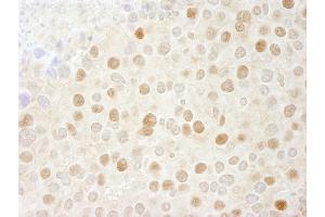 Immunohistochemistry (IHC) image for anti-Cyclin-Dependent Kinase 2 (CDK2) (AA 248-298) antibody (ABIN7448471)