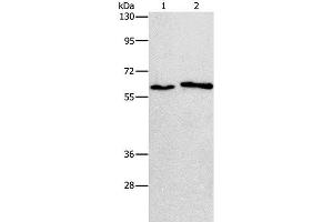 Western Blot analysis of A172 and A549 cell using CHRNA2 Polyclonal Antibody at dilution of 1:950 (CHRNA2 抗体)
