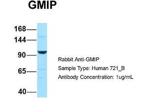 Host: Rabbit Target Name: GMIP Sample Type: Human 721_B Antibody Dilution: 1.