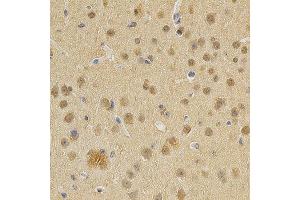 Immunohistochemistry (IHC) image for anti-DNA (Cytosine-5-)-Methyltransferase 3 alpha (DNMT3A) (AA 500-700) antibody (ABIN3022834)