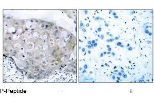 Image no. 1 for anti-VEGF Receptor 2 (VEGFR2) (pTyr951) antibody (ABIN196771) (VEGFR2/CD309 抗体  (pTyr951))