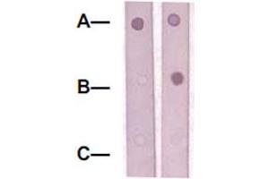 Dot Blot : 1 ug peptide was blot onto NC membrane. (SOX9 抗体  (pSer181))