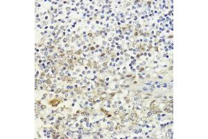 Immunohistochemistry of paraffin-embedded human tonsil using LDB1 antibody (ABIN7268255) at dilution of 1:200 (40x lens). (LIM Domain Binding 1 Protein 抗体  (AA 1-50))