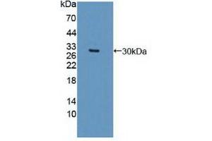 Western blot analysis of recombinant Human DCLK1. (DCLK1 抗体  (AA 390-647))