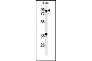 Western blot analysis of PATL1 Antibody (C-term) in HL-60 cell line lysates (35ug/lane). (PATL1 抗体  (C-Term))