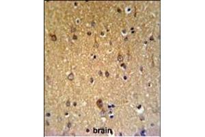 Immunohistochemistry (Paraffin-embedded Sections) (IHC (p)) image for anti-Zinc Finger, DHHC-Type Containing 9 (ZDHHC9) (AA 335-364), (C-Term) antibody (ABIN653671)