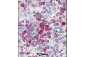 Formalin-fixed and paraffin-embedded human Spleen tissue reacted with PIM3 antibody (C-term) (ABIN391253 and ABIN2841313) , which was peroxidase-conjugated to the secondary antibody, followed by AEC staining. (PIM3 抗体  (C-Term))