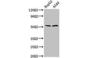 Western Blot Positive WB detected in: HepG2 whole cell lysate, A549 whole cell lysate All lanes: SPRED1 antibody at 3 μg/mL Secondary Goat polyclonal to rabbit IgG at 1/50000 dilution Predicted band size: 51 kDa Observed band size: 51 kDa (SPRED1 抗体  (AA 123-311))