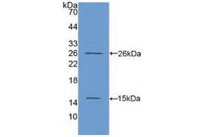 Detection of Recombinant Ki67P, Human using Polyclonal Antibody to Ki-67 Protein (Ki-67) (Ki-67 抗体  (AA 2815-2928))