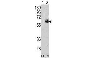 Image no. 1 for anti-Microtubule-Associated Protein tau (MAPT) (C-Term) antibody (ABIN357423) (MAPT 抗体  (C-Term))
