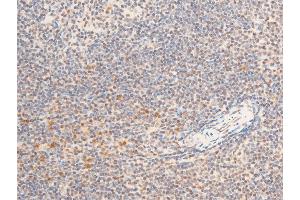 Immunohistochemistry (IHC) image for anti-Neurotrophic Tyrosine Kinase, Receptor, Type 1 (NTRK1) (pTyr681), (Tyr680) antibody (ABIN6256787)