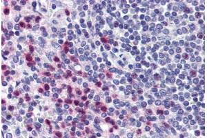 Human Spleen (formalin-fixed, paraffin-embedded) stained with STRAP antibody ABIN290242 at 10 ug/ml followed by biotinylated goat anti-rabbit IgG secondary antibody ABIN481713, alkaline phosphatase-streptavidin and chromogen. (STRAP 抗体  (AA 230-280))