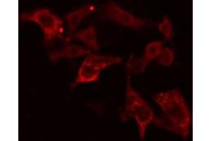 Immunofluorescence (fixed cells) (IF/ICC) image for anti-Cytochrome P450, Family 26, Subfamily A, Polypeptide 1 (CYP26A1) (Internal Region) antibody (ABIN6258057)