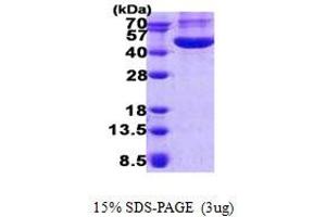 Image no. 1 for Chitinase 3-Like 1 (Cartilage Glycoprotein-39) (CHI3L1) protein (His tag) (ABIN6387124) (CHI3L1 Protein (His tag))