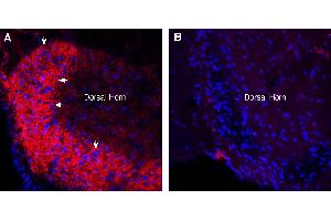 Expression of Synaptotagmin-1 in rat spinal cord. (Synaptotagmin I (SYT1) Peptide)