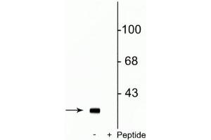 Western blot of rat striatal lysate showing specific immunolabeling of the ~32 kDa DARPP-32 phosphorylated at Ser137 in the first lane (-).