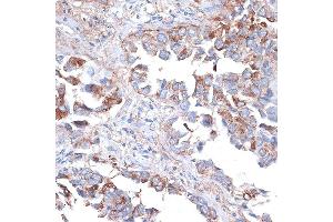 Immunohistochemistry (IHC) image for anti-Hepatitis A Virus Cellular Receptor 2 (TIM 3) (AA 22-202) antibody (ABIN3016173)