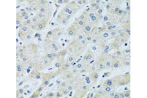 Immunohistochemistry of paraffin-embedded Human liver using SLC5A6 Polyclonal Antibody at dilution of 1:100 (40x lens). (SLC5A6 抗体)