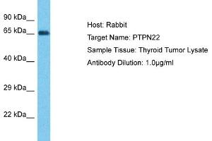 Host: Rabbit Target Name: PTPN22 Sample Type: Thyroid Tumor lysates Antibody Dilution: 1. (PTPN22 抗体  (Middle Region))