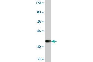 Western Blot detection against Immunogen (36. (Recoverin 抗体  (AA 101-199))
