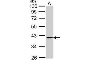WB Image Sample (30 ug of whole cell lysate) A: A431 , 10% SDS PAGE antibody diluted at 1:1000 (TALDO1 抗体  (N-Term))
