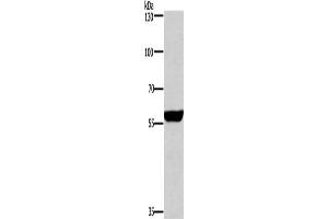 Gel: 6 % SDS-PAGE, Lysate: 40 μg, Lane: Mouse brain tissue, Primary antibody: ABIN7130690(PPP3CA Antibody) at dilution 1/650, Secondary antibody: Goat anti rabbit IgG at 1/8000 dilution, Exposure time: 1 second (PPP3CA 抗体)