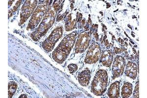 IHC-P Image ALDH2 antibody detects ALDH2 protein at mitochondria on mouse colon by immunohistochemical analysis. (ALDH2 抗体  (Center))