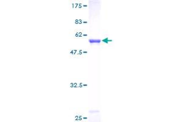 MTAP Protein (AA 1-283) (GST tag)