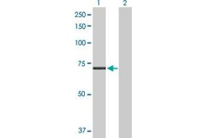 Western Blot analysis of CPT2 expression in transfected 293T cell line by CPT2 MaxPab polyclonal antibody. (CPT2 抗体  (AA 1-658))