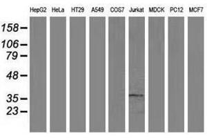 Image no. 3 for anti-Aminoacylase 3 (ACY3) antibody (ABIN1496463) (Aminoacylase 3 抗体)