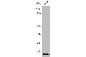 Western Blot analysis of HeLa cells using Amylin Polyclonal Antibody (Amylin/DAP 抗体  (N-Term))