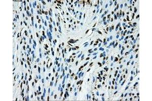 Immunohistochemical staining of paraffin-embedded Ovary tissue using anti-GRIPAP1mouse monoclonal antibody. (GRIPAP1 抗体)