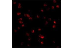 Immunofluorescence of TLR8 in Daudi cells with TLR8 antibody at 10 µg/ml. (TLR8 抗体  (Middle Region))