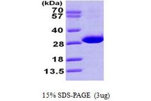 Carbonyl Reductase 4 (CBR4) (AA 1-237) protein (His tag)