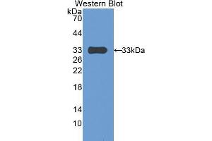 Western blot analysis of the recombinant protein. (PAPPA 抗体  (AA 1270-1558))