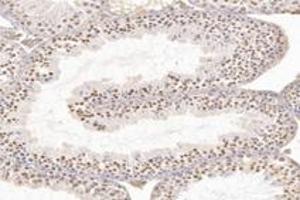 Immunohistochemistry analysis of paraffin-embedded rat testis using,WDR92 (ABIN7076222) at dilution of 1: 4200 (WDR92 抗体)