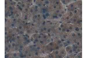 Detection of APOC1 in Human Liver Tissue using Polyclonal Antibody to Apolipoprotein C1 (APOC1) (APOC1 抗体  (AA 31-83))